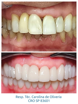 resultados-holy-odontologia10