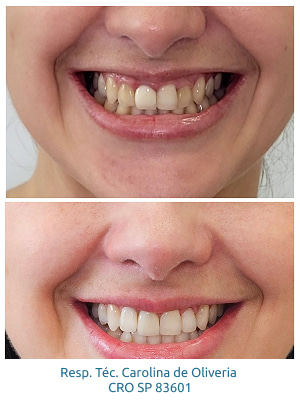 resultados-holy-odontologia11