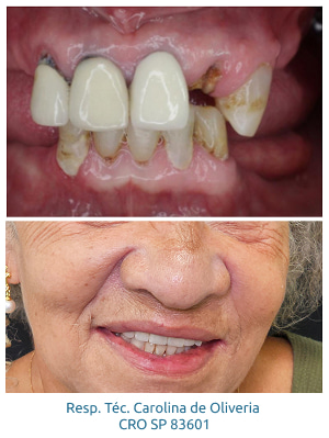 resultados-holy-odontologia12