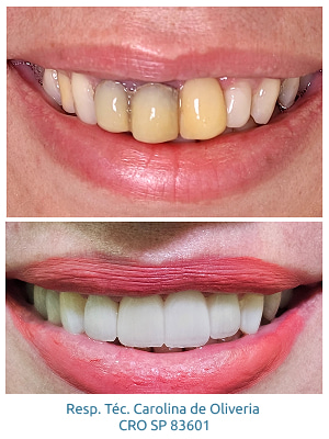 resultados-holy-odontologia13
