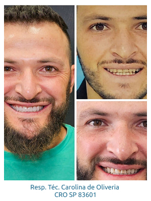 resultados-holy-odontologia5