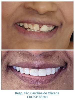 resultados-holy-odontologia7