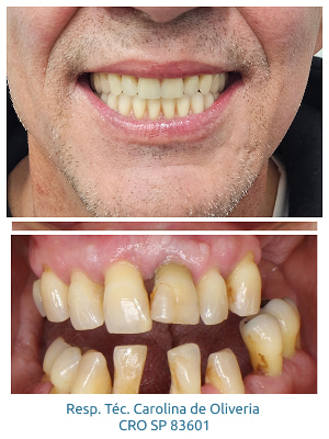 resultados-holy-odontologia9